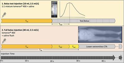 Low-iodine 40-keV virtual monoenergetic CT angiography of the lower extremities
